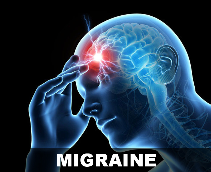 Treatment for Migraine