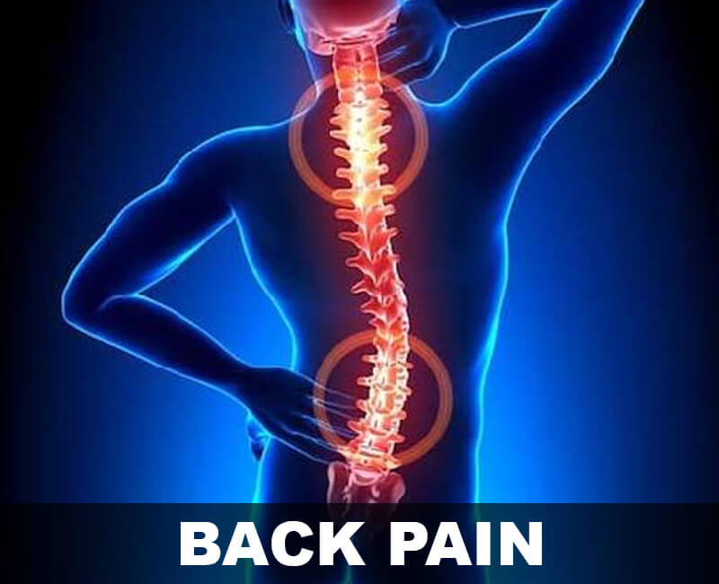 Treatment for Back Pain